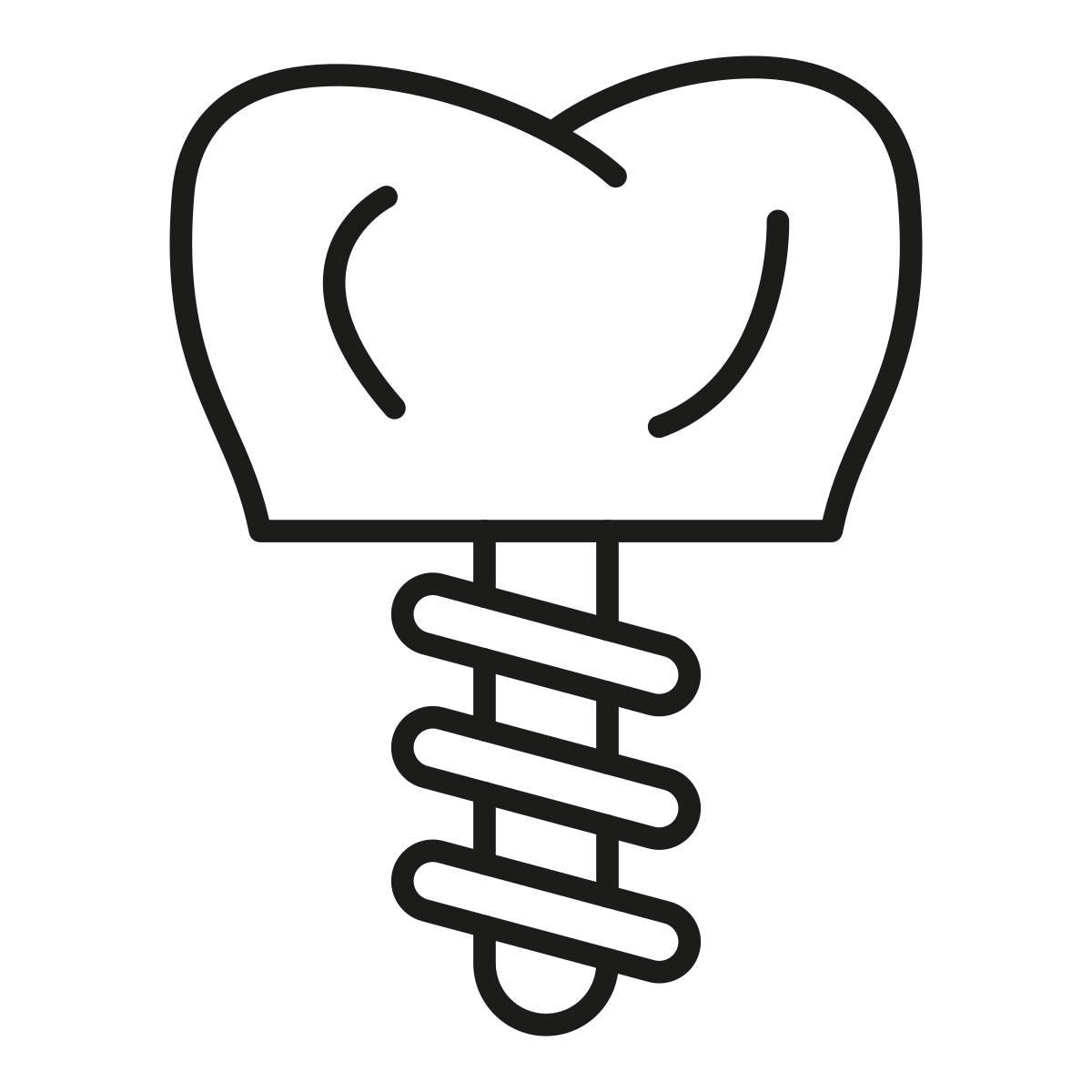 implante Clinica dental en Guadalajara